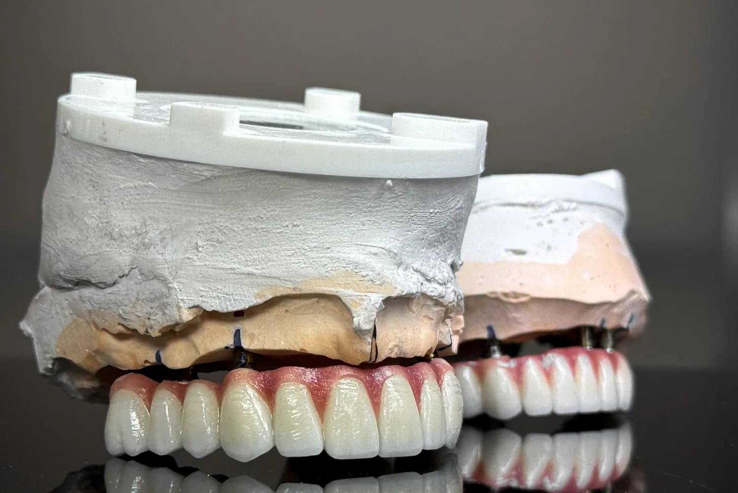 Una rehabilitación completa sobre implantes, con los dos modelos articulados
